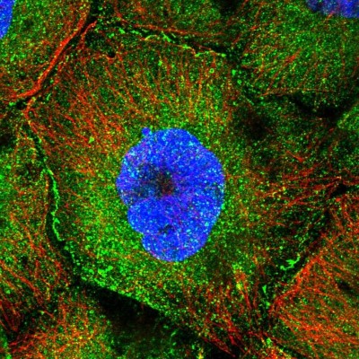 Immunocytochemistry/Immunofluorescence: CCDC8 Antibody [NBP1-85085] - Immunofluorescent staining of human cell line A-431 shows localization to plasma membrane & cytosol.