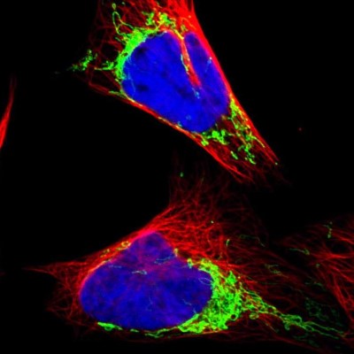 Immunocytochemistry/Immunofluorescence: SLC25A10 Antibody [NBP1-85215] - Immunofluorescent staining of human cell line U-2 OS shows localization to mitochondria.