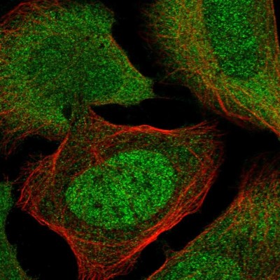 Immunocytochemistry/Immunofluorescence: TIGD4 Antibody [NBP1-86303] - Immunofluorescent staining of human cell line U-2 OS shows localization to nucleoplasm & cytosol.