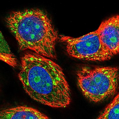 Immunocytochemistry/Immunofluorescence: MIF4GD Antibody [NBP2-30627] - Immunofluorescent staining of human cell line MCF7 shows localization to nucleoli & cytosol.