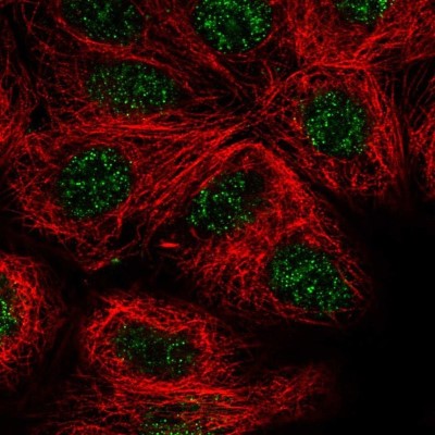 Immunocytochemistry/Immunofluorescence: JDP2 Antibody [NBP2-31775] - Staining of human cell line MCF7 shows positivity in nucleus but excluded from the nucleoli.