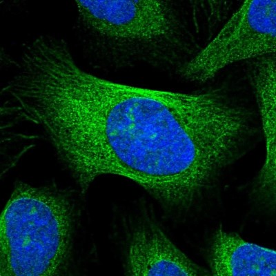Immunocytochemistry/Immunofluorescence: KIF2B Antibody [NBP1-89446] - Immunofluorescent staining of human cell line U-2 OS shows localization to nucleoli & microtubules.