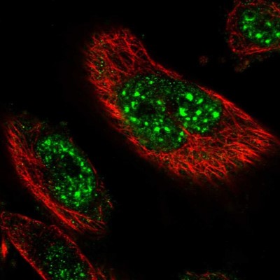Immunocytochemistry/Immunofluorescence: DEXI Antibody [NBP1-81015] - Immunofluorescent staining of human cell line U-251 MG shows localization to nuclear speckles.