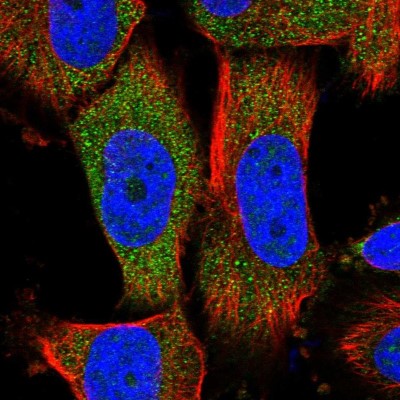 Immunocytochemistry/Immunofluorescence: MOCS2 Antibody [NBP1-81045] - Immunofluorescent staining of human cell line U-251 MG shows localization to cytosol.