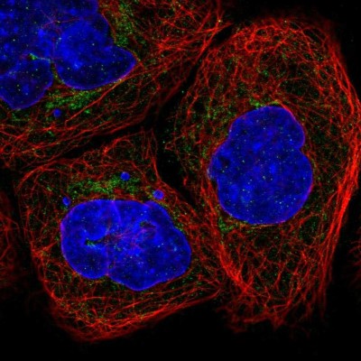Immunocytochemistry/Immunofluorescence: ETHE1 Antibody [NBP1-81690] - Immunofluorescent staining of human cell line A-431 shows localization to mitochondria.