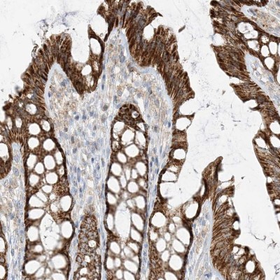 Immunocytochemistry/Immunofluorescence: ETHE1 Antibody [NBP1-81690] - Staining of human colon shows strong cytoplasmic positivity in glandular cells.
