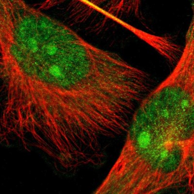 Immunocytochemistry/Immunofluorescence: TAO2 Antibody [NBP1-81465] - Immunofluorescent staining of human cell line U-251 MG shows localization to nucleus, nucleoli & cytosol.