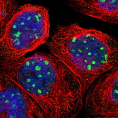 Immunocytochemistry/Immunofluorescence: RRP1B Antibody [NBP1-81534] - Immunofluorescent staining of human cell line A-431 shows localization to nucleoli.