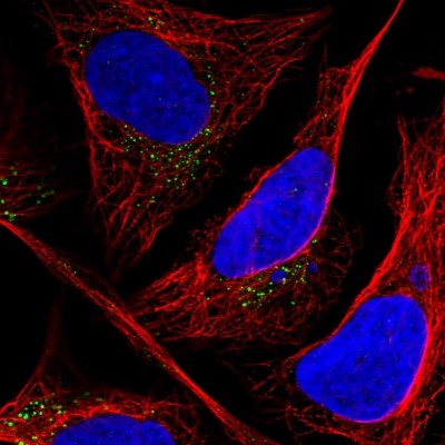 Immunocytochemistry/Immunofluorescence: CLIP4 Antibody [NBP1-91793] - Immunofluorescent staining of human cell line U-2 OS shows localization to vesicles.