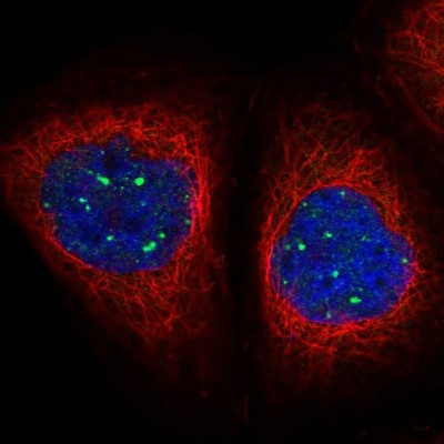 Immunocytochemistry/Immunofluorescence: MED19 Antibody [NBP1-81319] - Immunofluorescent staining of human cell line A-431 shows localization to nuclear bodies.