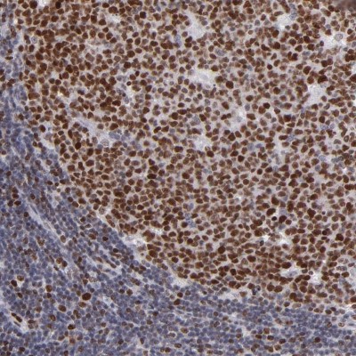Immunocytochemistry/Immunofluorescence: DNA polymerase alpha Antibody [NBP1-82449] - Staining of human lymph node shows strong nuclear positivity in germinal center cells.