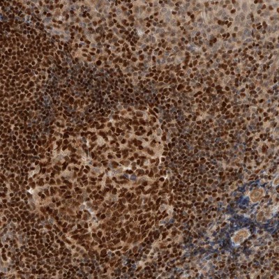 Immunohistochemistry-Paraffin: C8orf76 Antibody [NBP1-82221] - Staining of human tonsil shows strong nuclear positivity in most cells.