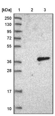 Western Blot: Protease Inhibitor 15 Antibody [NBP1-82445] - Lane 1: Marker [kDa] 250, 130, 95, 72, 55, 36, 28, 17, 10. Lane 2: Negative control (vector only transfected HEK293T lysate). Lane 3: Over-expression lysate (Co-expressed with a C-terminal myc-DDK tag (3.1 kDa) in mammalian HEK293T cells).