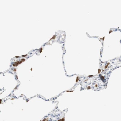 Immunohistochemistry-Paraffin: Protease Inhibitor 15 Antibody [NBP1-82445] - Staining of human lung shows strong cytoplasmic positivity in alveolar macrophages.