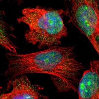 Immunocytochemistry/Immunofluorescence: HS3ST2 Antibody [NBP1-89374] - Staining of human cell line U-251MG shows positivity in nucleus, nucleoli and cytoplasm.