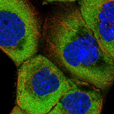 Immunocytochemistry/Immunofluorescence: TXNDC9 Antibody [NBP1-89051] - Immunofluorescent staining of human cell line A-431 shows localization to cytosol.