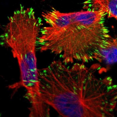 Immunocytochemistry/Immunofluorescence: HS3ST5 Antibody [NBP1-89373] - Staining of human cell line U-251MG shows positivity in focal adhesions.