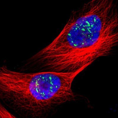 Immunocytochemistry/Immunofluorescence: BRD1 Antibody [NBP1-88351] - Staining of human cell line U-251MG shows positivity in nucleus.