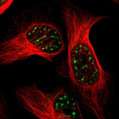 Immunocytochemistry/Immunofluorescence: BRD1 Antibody [NBP1-88351] - Immunofluorescent staining of human cell line U-2 OS shows localization to nuclear speckles.