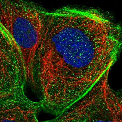 Immunocytochemistry/Immunofluorescence: PSTK Antibody [NBP1-88541] - Staining of human cell line A-431 shows localization to nuclear bodies & actin filaments.