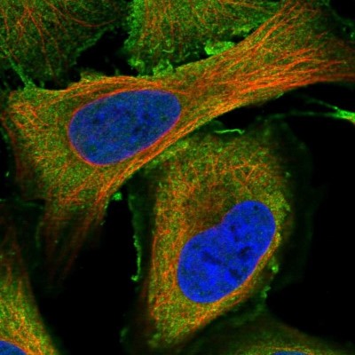 Immunocytochemistry/Immunofluorescence: MURF3 Antibody [NBP1-92154] - Staining of human cell line U-2 OS shows positivity in plasma membrane and cytoplasm.
