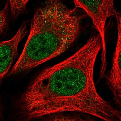 Immunocytochemistry/Immunofluorescence: PARP8 Antibody [NBP2-13733] - Staining of human cell line U-2 OS shows localization to nucleoplasm.