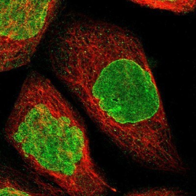 Immunocytochemistry/Immunofluorescence: BRIP1/FANCJ Antibody [NBP2-14361] - Staining of human cell line A-431 shows positivity in nucleus and nuclear membrane.