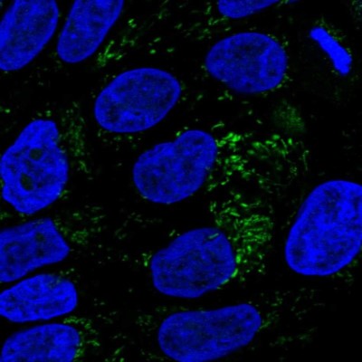 Immunocytochemistry/Immunofluorescence: HMGCS2 Antibody [NBP2-33908] - Immunofluorescent staining of human cell line RT4 shows localization to mitochondria.