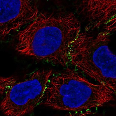 Immunocytochemistry/Immunofluorescence: PEPP3 Antibody [NBP1-87889] - Staining of human cell line RT4 shows localization to cell junctions.