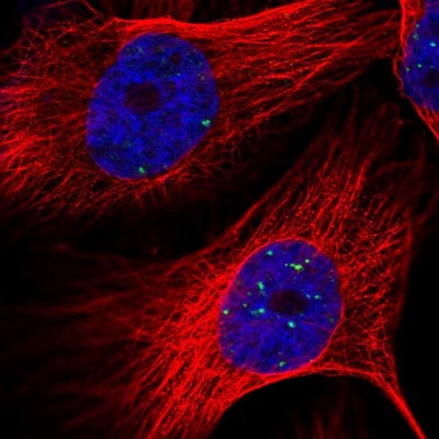 Immunocytochemistry/Immunofluorescence: LYRM4 Antibody [NBP1-86762] - Immunofluorescent staining of human cell line U-251 MG shows localization to nuclear bodies.
