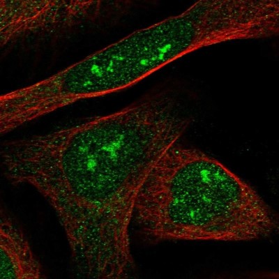 Immunocytochemistry/Immunofluorescence: C6orf146 Antibody [NBP1-93471] - Staining of human cell line U-2 OS shows positivity in nucleus and nucleoli.