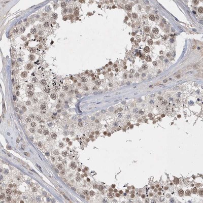 Immunohistochemistry-Paraffin: C6orf146 Antibody [NBP1-93471] - Staining of human testis shows moderate nuclear positivity in seminiferous duct cells.