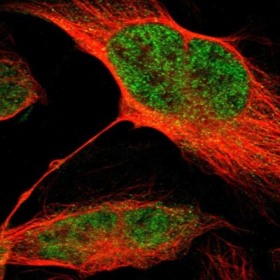 Immunocytochemistry/Immunofluorescence: MLF2 Antibody [NBP1-82518] - Immunofluorescent staining of human cell line U-2 OS shows localization to nucleoplasm.