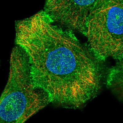 Immunocytochemistry/Immunofluorescence: Integrin beta 4/CD104 Antibody [NBP2-38297] - Immunofluorescent staining of human cell line HaCaT shows localization to nucleus, plasma membrane & cell junctions.