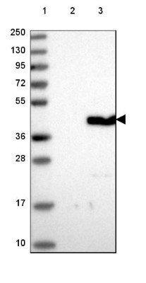 Western Blot: C6orf106 Antibody [NBP2-48623] - Lane 1: Marker [kDa] 250, 130, 95, 72, 55, 36, 28, 17, 10Lane 2: Negative control (vector only transfected HEK293T lysate)Lane 3: Over-expression lysate (Co-expressed with a C-terminal myc-DDK tag (~3.1 kDa) in mammalian HEK293T cells, LY411330)
