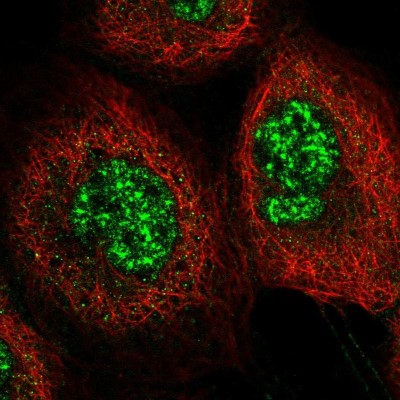 Immunocytochemistry/Immunofluorescence: C6orf106 Antibody [NBP2-48623] - Immunofluorescent staining of human cell line A-431 shows localization to nuclear speckles.