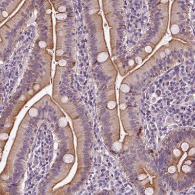 Immunohistochemistry-Paraffin: C6orf106 Antibody [NBP2-48623] - Staining of human small intestine shows membranous positivity in glandular cells.