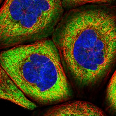 Immunocytochemistry/Immunofluorescence: HARS2 Antibody [NBP1-81775] - Immunofluorescent staining of human cell line A-431 shows localization to cytosol.