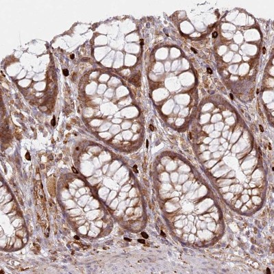 Immunocytochemistry/Immunofluorescence: HARS2 Antibody [NBP1-81775] - Staining of human colon shows moderate cytoplasmic positivity in glandular cells.