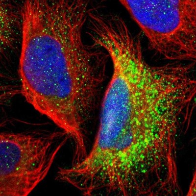 Immunocytochemistry/Immunofluorescence: GALNT8 Antibody [NBP1-81848] - Immunofluorescent staining of human cell line U-2 OS shows localization to vesicles.