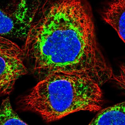 Immunocytochemistry/Immunofluorescence: Ribophorin II Antibody [NBP1-80835] - Immunofluorescent staining of human cell line A-431 shows localization to endoplasmic reticulum.