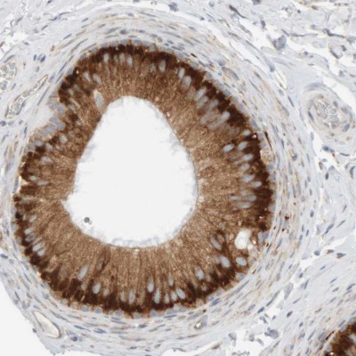Immunocytochemistry/Immunofluorescence: Ribophorin II Antibody [NBP1-80835] - Staining of human epididymis shows strong cytoplasmic positivity in glandular cells.