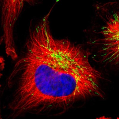 Immunocytochemistry/Immunofluorescence: PITRM1 Antibody [NBP1-81729] - Immunofluorescent staining of human cell line U-251 MG shows localization to mitochondria.