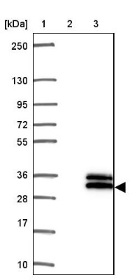 Western Blot: C3orf62 Antibody [NBP1-81899] - Lane 1: Marker [kDa] 250, 130, 95, 72, 55, 36, 28, 17, 10. Lane 2: Negative control (vector only transfected HEK293T lysate). Lane 3: Over-expression lysate (Co-expressed with a C-terminal myc-DDK tag (3.1 kDa) in mammalian HEK293T cells).
