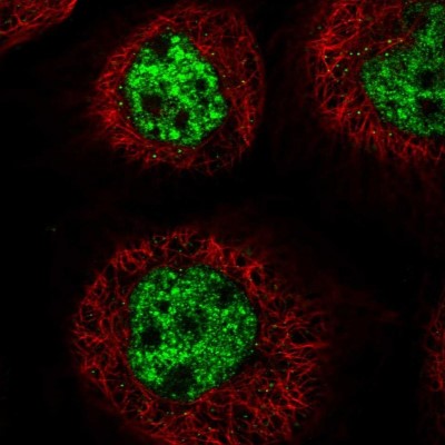 Immunocytochemistry/Immunofluorescence: C3orf62 Antibody [NBP1-81899] - Immunofluorescent staining of human cell line A-431 shows localization to nuclear speckles.