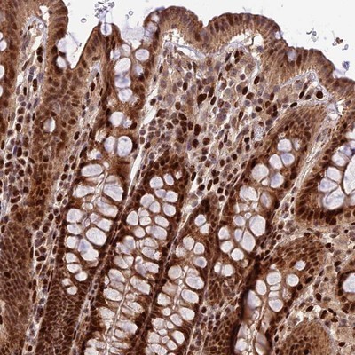 Immunohistochemistry-Paraffin: C3orf62 Antibody [NBP1-81899] - Staining of human colon shows strong cytoplasmic and nuclear positivity in glandular cells.