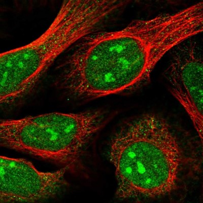 Immunocytochemistry/Immunofluorescence: GRWD1 Antibody [NBP1-81790] - Immunofluorescent staining of human cell line U-2 OS shows localization to nucleus, nucleoli & cytosol.