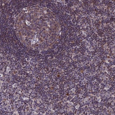 Immunocytochemistry/Immunofluorescence: GRWD1 Antibody [NBP1-81790] - Staining of human lymph node shows nuclear positivity.
