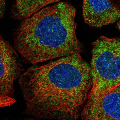 Immunocytochemistry/Immunofluorescence: CSGALNACT2 Antibody [NBP1-81851] - Immunofluorescent staining of human cell line A-431 shows localization to endoplasmic reticulum.