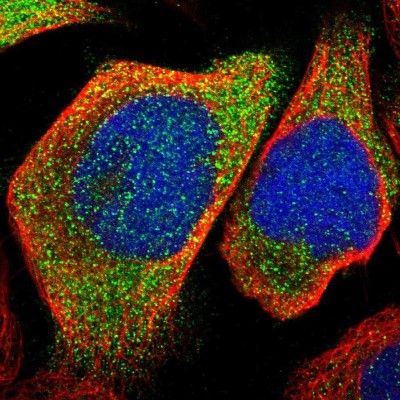 Immunocytochemistry/Immunofluorescence: KLHDC1 Antibody [NBP1-82616] - Immunofluorescent staining of human cell line A-431 shows localization to cytosol.